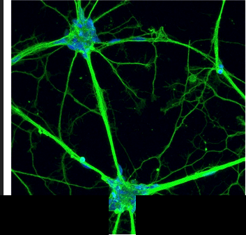 Fluorescent microscopy of patient-derived neural stem cells and neurons showing wild-type morphology